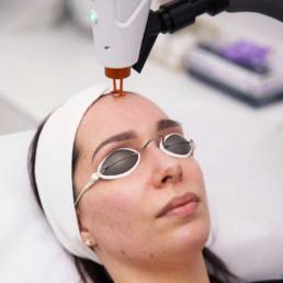 Nurse performs Laser Facial on client